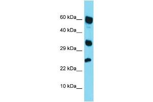 Western Blotting (WB) image for anti-Retinoic Acid Receptor Responder (Tazarotene Induced) 1 (RARRES1) (Middle Region) antibody (ABIN2499940) (RARRES1 抗体  (Middle Region))