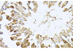 Immunohistochemistry of paraffin-embedded Rat testis using PSMA7 Polyclonal Antibody at dilution of 1:100 (40x lens). (PSMA7 抗体)