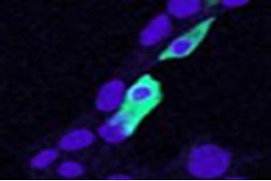 Immunofluorescence (IF) image for anti-Chloride Intracellular Channel 4 (CLIC4) antibody (ABIN5861496) (CLIC4 抗体)
