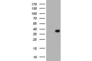 HEK293T cells were transfected with the pCMV6-ENTRY control (Left lane) or pCMV6-ENTRY LRRC39 (Right lane) cDNA for 48 hrs and lysed. (LRRC39 抗体)