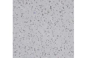 Immunohistochemistry (IHC) image for anti-Oligodendrocyte Lineage Transcription Factor 2 (OLIG2) (AA 200-300) antibody (ABIN7504157)