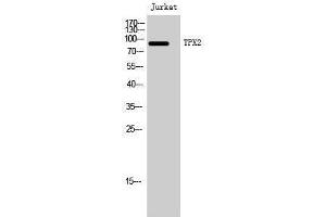 Western Blotting (WB) image for anti-TPX2, Microtubule-Associated, Homolog (Xenopus Laevis) (TPX2) (Internal Region) antibody (ABIN3187315) (TPX2 抗体  (Internal Region))