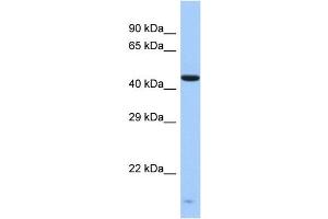 Host:  Rabbit  Target Name:  ZNF701  Sample Type:  Fetal Liver lysates  Antibody Dilution:  1. (ZNF701 抗体  (Middle Region))