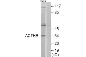Western Blotting (WB) image for anti-Melanocortin 2 Receptor (Adrenocorticotropic Hormone) (MC2R) (C-Term) antibody (ABIN1852923) (MC2R 抗体  (C-Term))