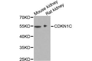 Western blot analysis of extracts of various cell lines, using CDKN1C antibody (ABIN1871758) at 1:1000 dilution. (CDKN1C 抗体)