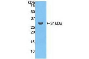Detection of Recombinant FCN3, Human using Polyclonal Antibody to Ficolin 3 (FCN3) (FCN3 抗体  (AA 34-297))