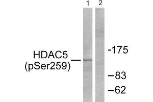 Western Blotting (WB) image for anti-Histone Deacetylase 5 (HDAC5) (pSer259) antibody (ABIN1847263) (HDAC5 抗体  (pSer259))