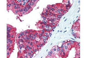 Anti-CD38 antibody IHC of human prostate. (CD38 抗体  (C-Term))