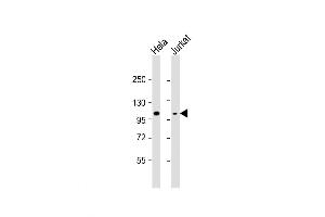 Western Blot at 1:8000 dilution Lane 1: Hela whole cell lysate Lane 2: Jurkat whole cell lysate Lysates/proteins at 20 ug per lane. (Retinoblastoma 1 抗体  (C-Term))