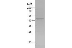 Western Blotting (WB) image for Apoptosis-Inducing Factor, Mitochondrion-Associated, 2 (AIFM2) (AA 161-373) protein (His-IF2DI Tag) (ABIN7121876) (AIFM2 Protein (AA 161-373) (His-IF2DI Tag))