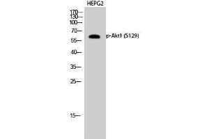 Western Blotting (WB) image for anti-V-Akt Murine Thymoma Viral Oncogene Homolog 1 (AKT1) (pSer129) antibody (ABIN3182221) (AKT1 抗体  (pSer129))