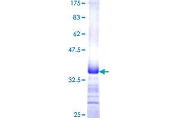 MUC5AC Protein (AA 351-450) (GST tag)