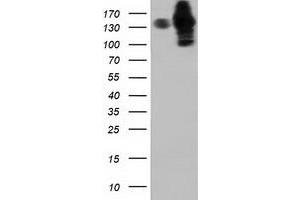 HEK293T cells were transfected with the pCMV6-ENTRY control (Left lane) or pCMV6-ENTRY HDAC6 (Right lane) cDNA for 48 hrs and lysed. (HDAC6 抗体)