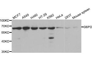 Western blot analysis of extracts of various cell lines, using G6PD antibody (ABIN5970726) at 1/1000 dilution. (Glucose-6-Phosphate Dehydrogenase 抗体)