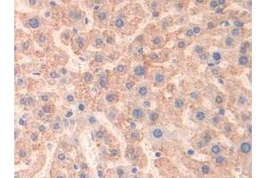 Detection of MAOB in Mouse Liver Tissue using Polyclonal Antibody to Monoamine Oxidase B (MAOB) (Monoamine Oxidase B 抗体  (AA 206-505))