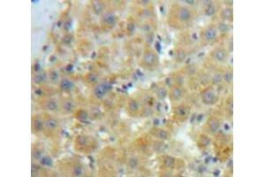 Used in DAB staining on fromalin fixed paraffin-embedded Liver tissue (Caldesmon 抗体  (AA 28-207))
