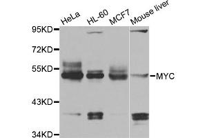 Western blot analysis of extracts of various cell lines, using MYC antibody (ABIN5996012) at 1/1000 dilution. (c-MYC 抗体)