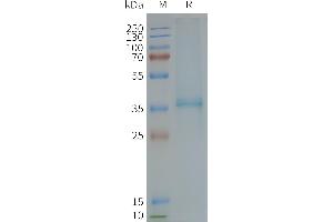Human -Nanodisc, Flag Tag on SDS-PAGE (XCR1 蛋白)