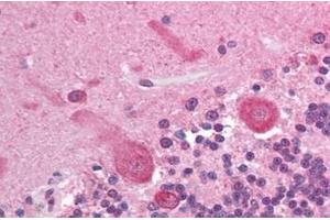 Immunohistochemistry (IHC) image for anti-V-Akt Murine Thymoma Viral Oncogene Homolog 3 (Protein Kinase B, Gamma) (AKT3) (AA 119-136) antibody (ABIN302246) (AKT3 抗体  (AA 119-136))