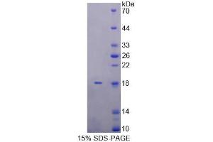 SDS-PAGE (SDS) image for Killer Cell Lectin-Like Receptor Subfamily K, Member 1 (KLRK1) (AA 75-215) protein (His tag) (ABIN6238789) (KLRK1 Protein (AA 75-215) (His tag))