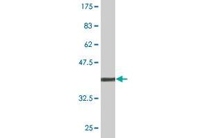 Western Blot detection against Immunogen (43. (SH3GL1 抗体  (AA 1-369))