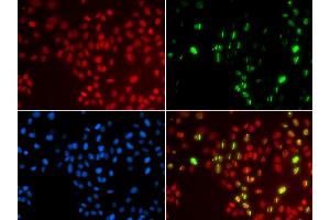 Immunofluorescence analysis of GFP-RNF168 transgenic U2OS cells using POLH antibody (ABIN5970934). (POLH 抗体)