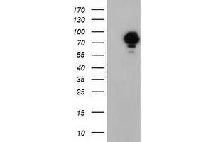 HEK293T cells were transfected with the pCMV6-ENTRY control (Left lane) or pCMV6-ENTRY VWA5A (Right lane) cDNA for 48 hrs and lysed. (VWA5A 抗体)