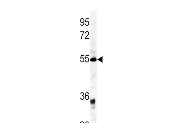 GDF6 抗体  (C-Term)