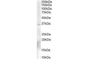 Western Blotting (WB) image for Nanos Homolog 1 (NANOS1) peptide (ABIN369852) (Nanos Homolog 1 (NANOS1) Peptide)