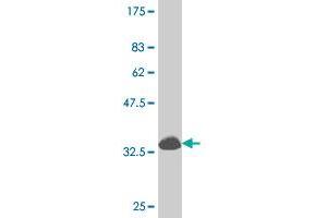 Western Blot detection against Immunogen (34. (DLX1 抗体  (AA 181-254))