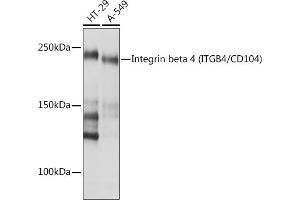 Western blot analysis of extracts of various cell lines, using Integrin beta 4 (ITGB4/CD104) (ITGB4/CD104) Rabbit mAb (ABIN7267931) at 1:1000 dilution. (Integrin beta 4 抗体)