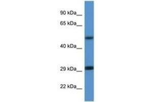 Image no. 1 for anti-Enolase 2 (Gamma, Neuronal) (ENO2) (AA 75-124) antibody (ABIN6746907) (ENO2/NSE 抗体  (AA 75-124))