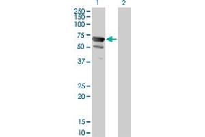 Western Blot analysis of NT5C2 expression in transfected 293T cell line by NT5C2 monoclonal antibody (M02), clone 3C1. (NT5C2 抗体  (AA 1-561))