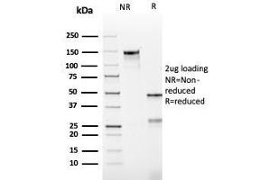 SDS-PAGE (SDS) image for anti-B-Cell CLL/lymphoma 2 (BCL2) antibody (ABIN6940491)