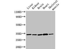 Western Blot Positive WB detected in: Rat liver tissue, Rat kidney tissue, Mouse brain tissue, Mouse heart tissue, Mouse skeletal muscle tissue All lanes: AHSA2P antibody at 3 μg/mL Secondary Goat polyclonal to rabbit IgG at 1/50000 dilution Predicted band size: 34, 17, 16 kDa Observed band size: 34 kDa (AHSA2P (AA 1-137) 抗体)
