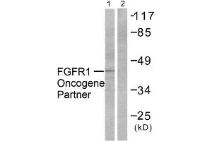 Western Blotting (WB) image for anti-FGFR1 Oncogene Partner (FGFR1OP) (C-Term) antibody (ABIN1848539) (FGFR1OP 抗体  (C-Term))