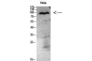 Western Blot (WB) analysis of HeLa cells using Antibody diluted at 1:1000. (CD56 抗体)