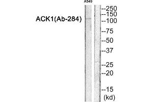 Western Blotting (WB) image for anti-tyrosine Kinase, Non-Receptor, 2 (TNK2) (Tyr284) antibody (ABIN1847979) (TNK2 抗体  (Tyr284))