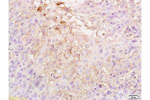 Immunohistochemistry (Paraffin-embedded Sections) (IHC (p)) image for anti-Hypoxia Inducible Factor 1, alpha Subunit (Basic Helix-Loop-Helix Transcription Factor) (HIF1A) (AA 341-450) antibody (ABIN672546)