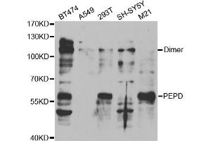 Western blot analysis of extracts of various cell lines, using PEPD antibody (ABIN5973143) at 1/1000 dilution. (PEPD 抗体)