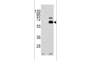 Western blot analysis of RPS6KB1 using rabbit polyclonal RPS6KB1 Antibody (S404) using 293 cell lysates (2 ug/lane) either nontransfected (Lane 1) or transiently transfected with the RPS6KB1 gene (Lane 2). (RPS6KB1 抗体  (AA 405-434))