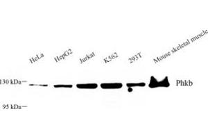 Western blot analysis of Phkb (ABIN7075075) at dilution of 1: 500 (PHKB 抗体)