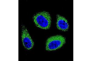 Immunofluorescence (IF) image for anti-7-Dehydrocholesterol Reductase (DHCR7) antibody (ABIN2996203) (DHCR7 抗体)