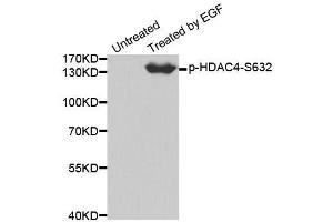Western blot analysis of extracts from 293 cells using Phospho-HDAC4-S632 antibody (ABIN2988040). (HDAC4 抗体  (pSer632))