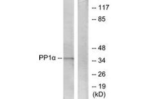 Western blot analysis of extracts from Jurkat cells, using PP1-alpha (Ab-320) Antibody. (PPP1CA 抗体  (AA 281-330))