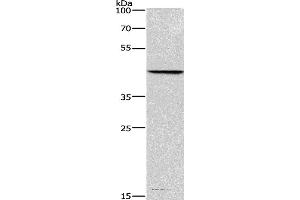 Western blot analysis of Hela cell, using BGN Polyclonal Antibody at dilution of 1:550 (Biglycan 抗体)
