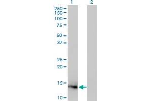 Western Blot analysis of IL2 expression in transfected 293T cell line by IL2 monoclonal antibody (M12), clone 1C1. (IL-2 抗体  (AA 21-153))