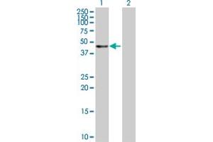 Western Blot analysis of KRT20 expression in transfected 293T cell line by KRT20 MaxPab polyclonal antibody. (KRT20 抗体  (AA 1-424))