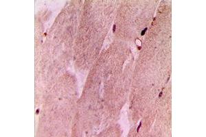 Immunohistochemical analysis of RPL3L staining in human muscle formalin fixed paraffin embedded tissue section. (RPL3L 抗体  (Center))