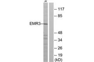 Western blot analysis of extracts from Jurkat cells, using EMR3 Antibody. (EMR3 抗体  (AA 603-652))